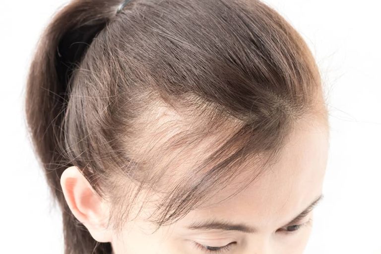 hair4